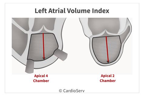 calculate left atrial volume index